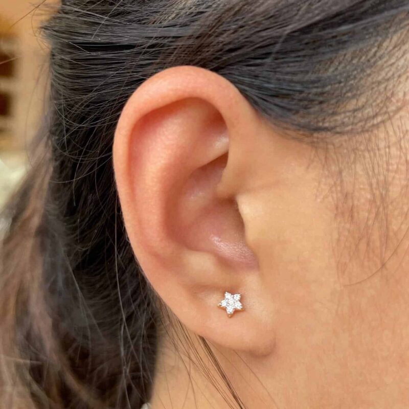 Star Diamond - Image 2